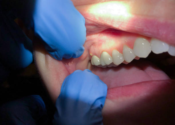 Best Emergency Dentist for Knocked-Out Tooth in Circle D Kc Estates, TX